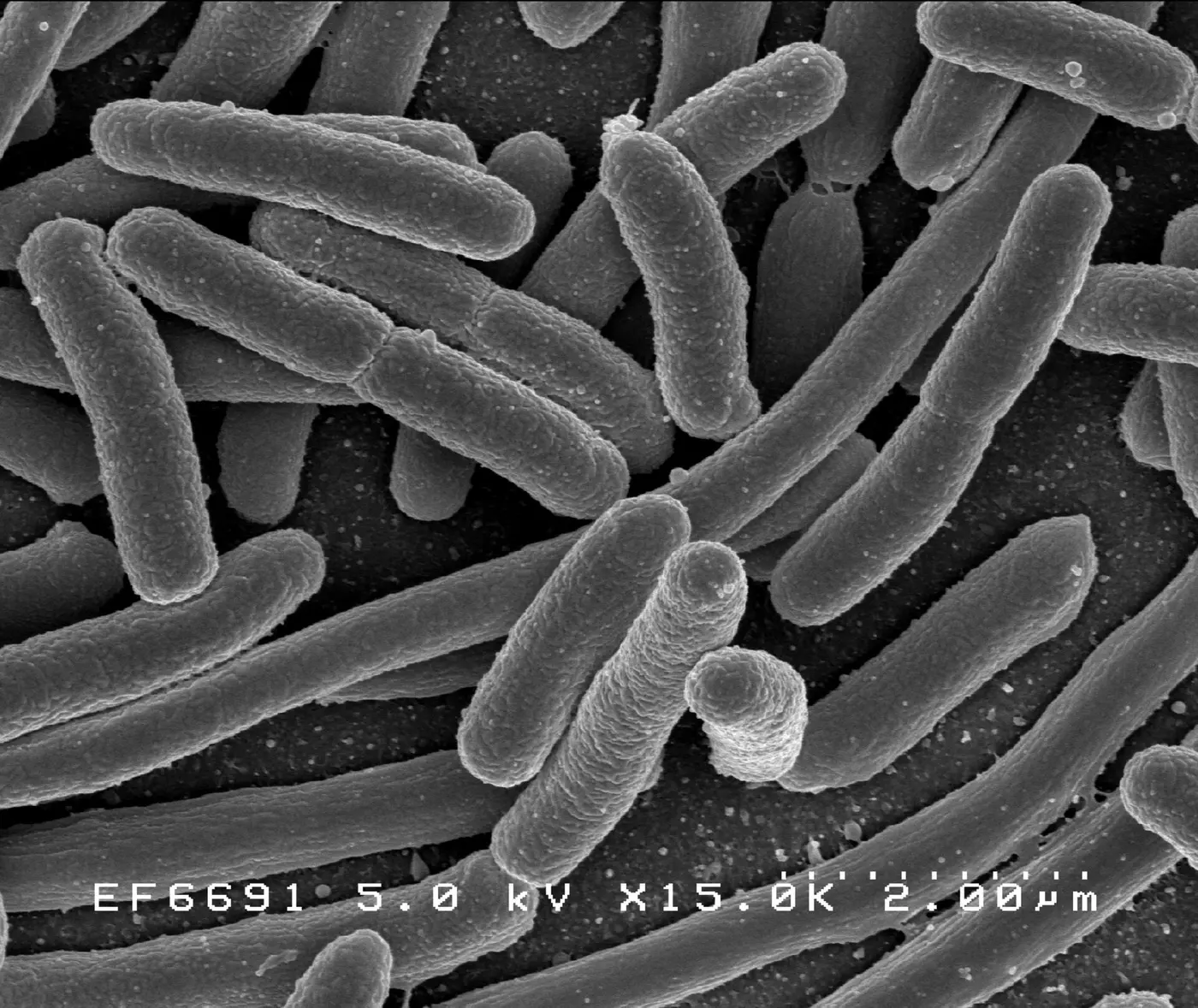 Many elongated, capsule-shaped bacteria piled on top of one another, seen through an electron microscope