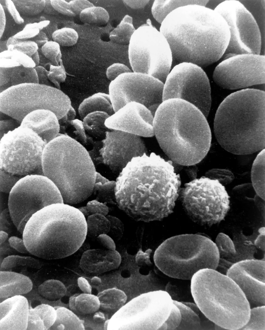 Blood seen through an electron microscope: many disc-shaped red blood cells with dimpled centers, mixed with round white blood cells with bumpy surfaces