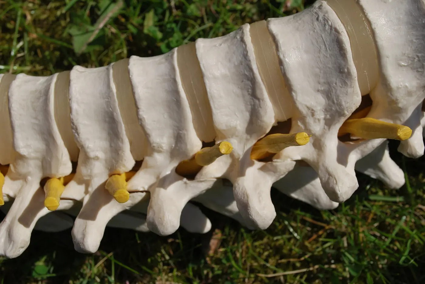 Close-up of a spine model, with translucent cushion-like discs between the white bones