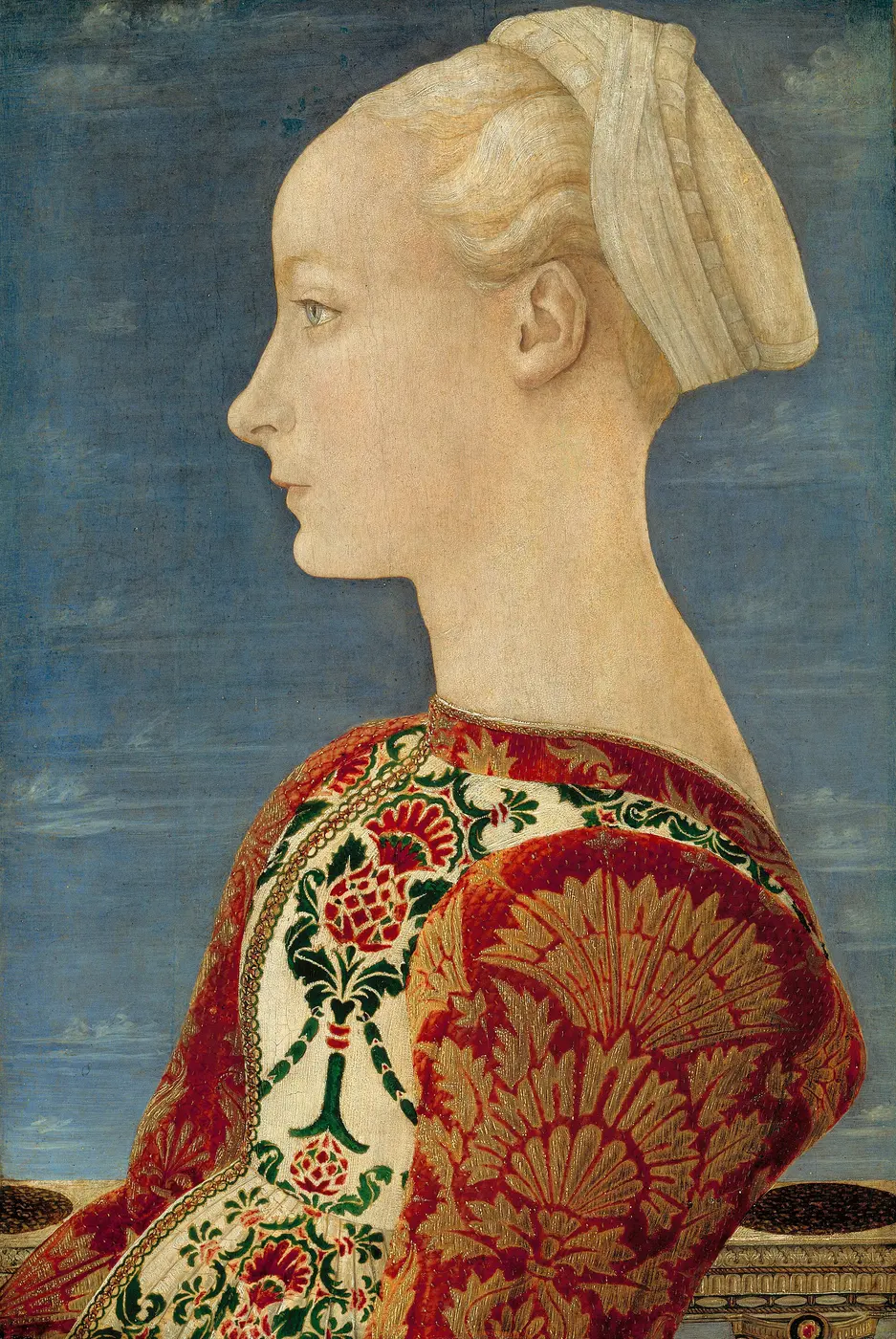 A profile portrait of a young woman with a broad forehead and barely visible eyebrows