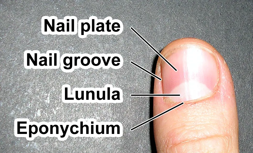 Photo of a thumbnail with English labels for the nail plate, nail groove, lunula and eponychium