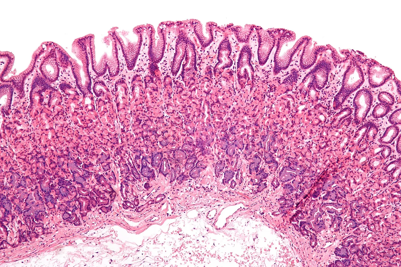 Human stomach lining under a microscope, with a finely rippled surface and rows of cells stained pink and purple