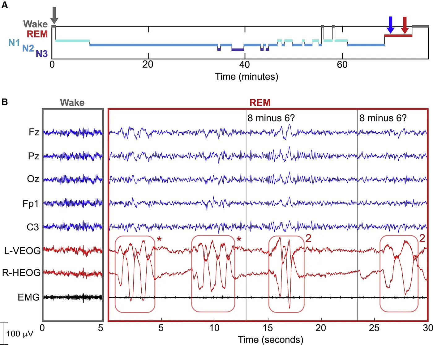 A graph showing the course of sleep, along with brain-wave and eye-movement traces